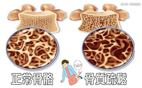 韓國(guó)骨密度測(cè)試儀